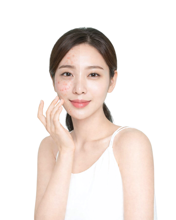 Other Services treatment at Bang's Prime Skin Aesthetics